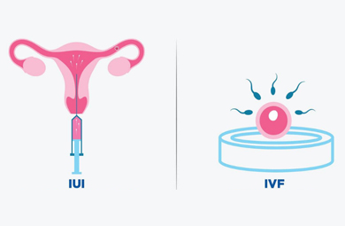 مراقبت‌های قبل از ivf و iui