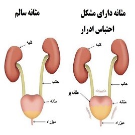 مشکلات ادراری در بارداری و پس از زایمان